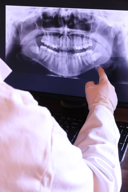 Best Emergency Treatment for Dental Infections or Abscesses in Lapwai, ID