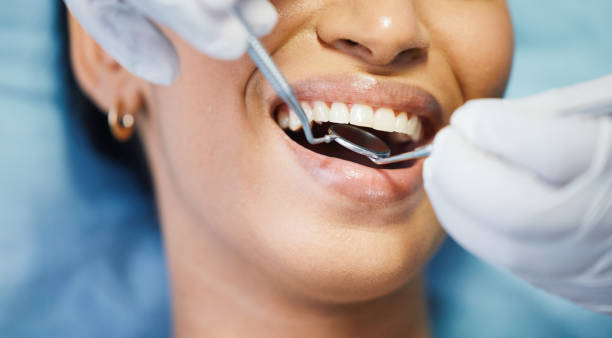 Best Emergency Gum Treatment in Lapwai, ID