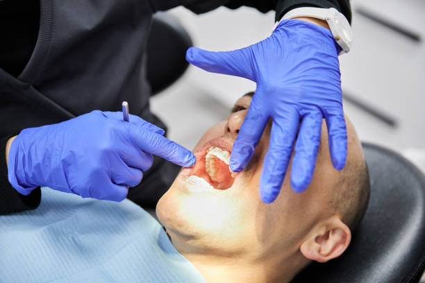 Best Emergency Dental Care for Broken or Chipped Teeth in Lapwai, ID